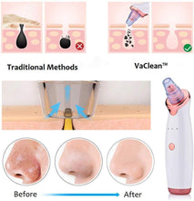 Load image into Gallery viewer, VaClean™