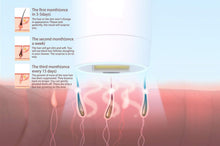 Load image into Gallery viewer, Optixer™ Pro