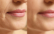 Load image into Gallery viewer, Porexo™
